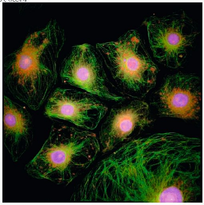 Set de filtres fluorescence multibandes