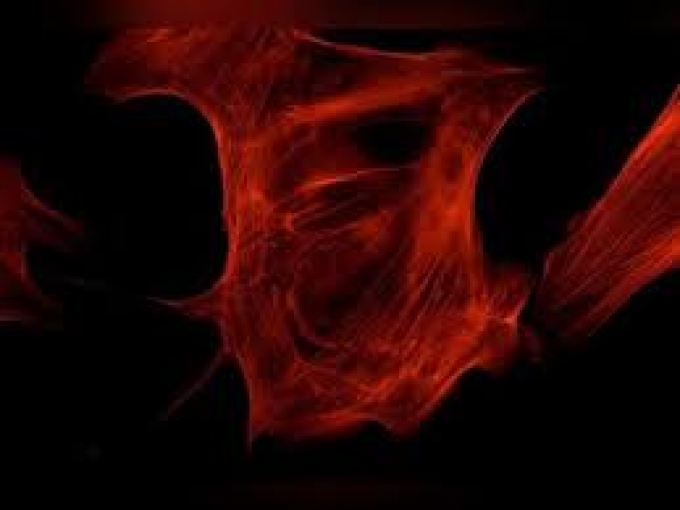 Set de filtres fluorescence Rhodamine